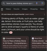 google how to pass kidney stones