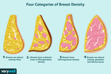 why-are-dense-breasts-a-breast-cancer-risk-430657-v1-8493c59449b8433a906c8394895a462c