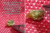 kidney-stone-tiktok-comp-1-1