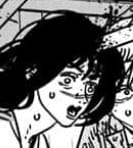 lobotomy