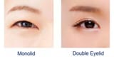 double-eyelid