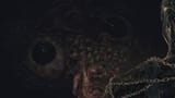 brain_of_mensis