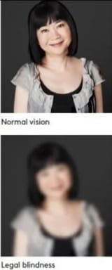 legal blindness