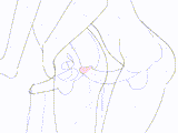 X-ray