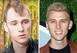 machine-gun-kelly-hair-transplant