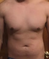 20%BF