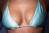 Stretch_Marks_on_Boobs__The_3_Best_Treatments
