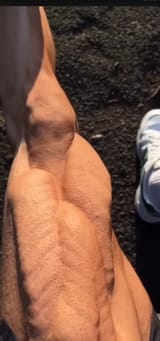 thighs