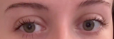 eyelids