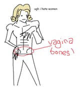 vbones