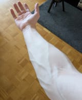 arm