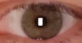 eyeball