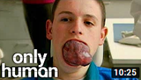 tongue guy