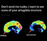 Sendamygdala