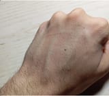 Hand