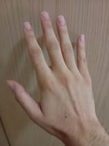 Hand