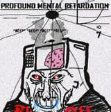 profound mental retardation