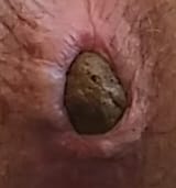 For Use