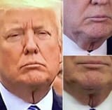 neckgina