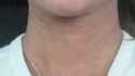 GatorSkin_thumb.jpg