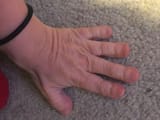 Hand1