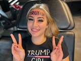 trump forehead