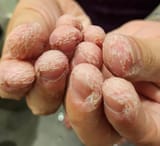 what-my-fingers-look-like-when-i-get-out-of-the-bath-after-v0-aiu3v02hs79b1