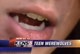 teenwolf