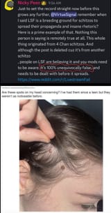 Melanoma