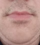 My beard 4