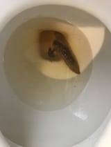 Fecal_poop