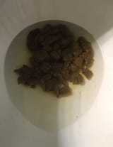 Fecal_poop_3