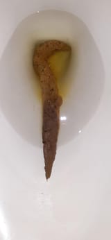 xmnkki9rf8u51