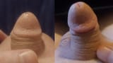 micropp2