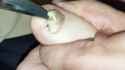 toenail_thumb.jpg