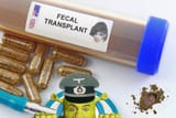 fecal.transplant.....