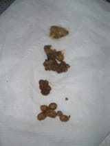 have-you-examined-your-stools-poo-lately