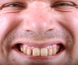 ugly-man-3253724