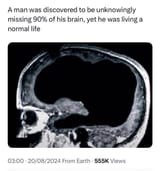 Brain90