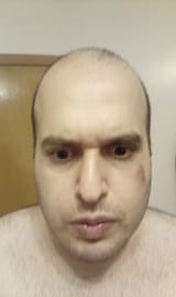 1720171048561768