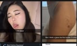 emilybruises