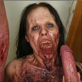 skin_rash