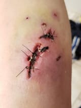 leg