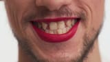 close-up-view-mouth-young-ugly-man-beard-moustache-red-painted-lips-stupid-smiling-show-broken-teeth-look-camera-209147613