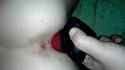 knotted_thumb.jpg