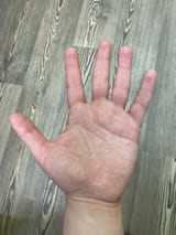 Hand