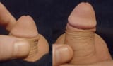 micropp5