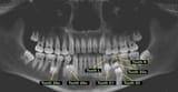 TOOTH