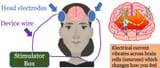 CRANIUM ELECTRODES