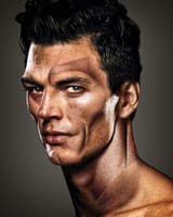 Incel Surgery